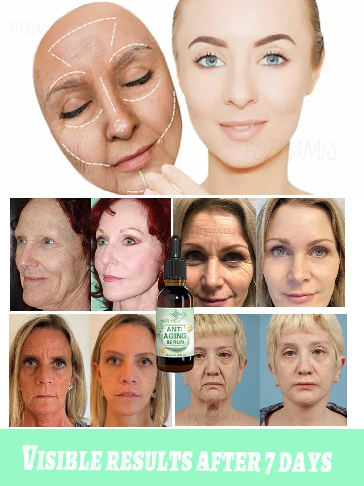 Wrinkles disappear, the first choice for beauty lovers