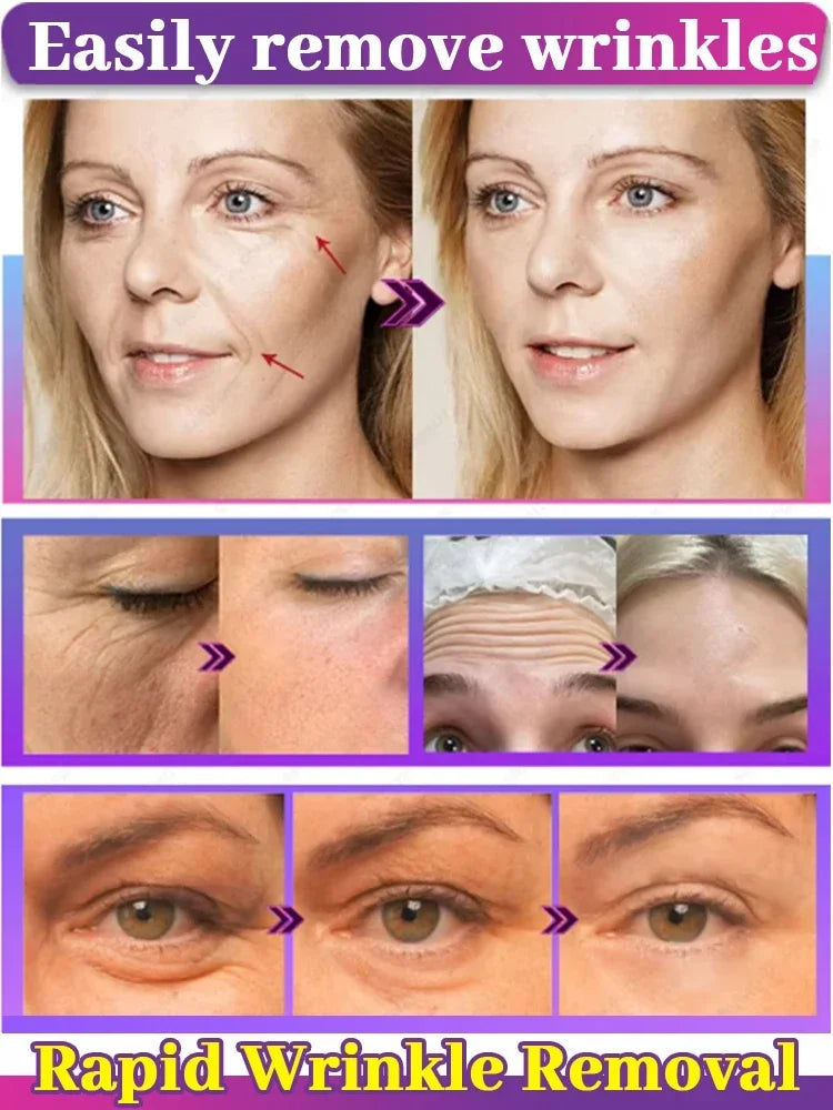 20 years younger, 100% wrinkles disappear