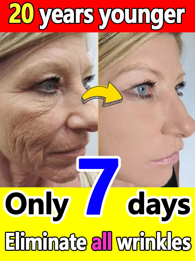 20 years younger, 100% wrinkles disappear