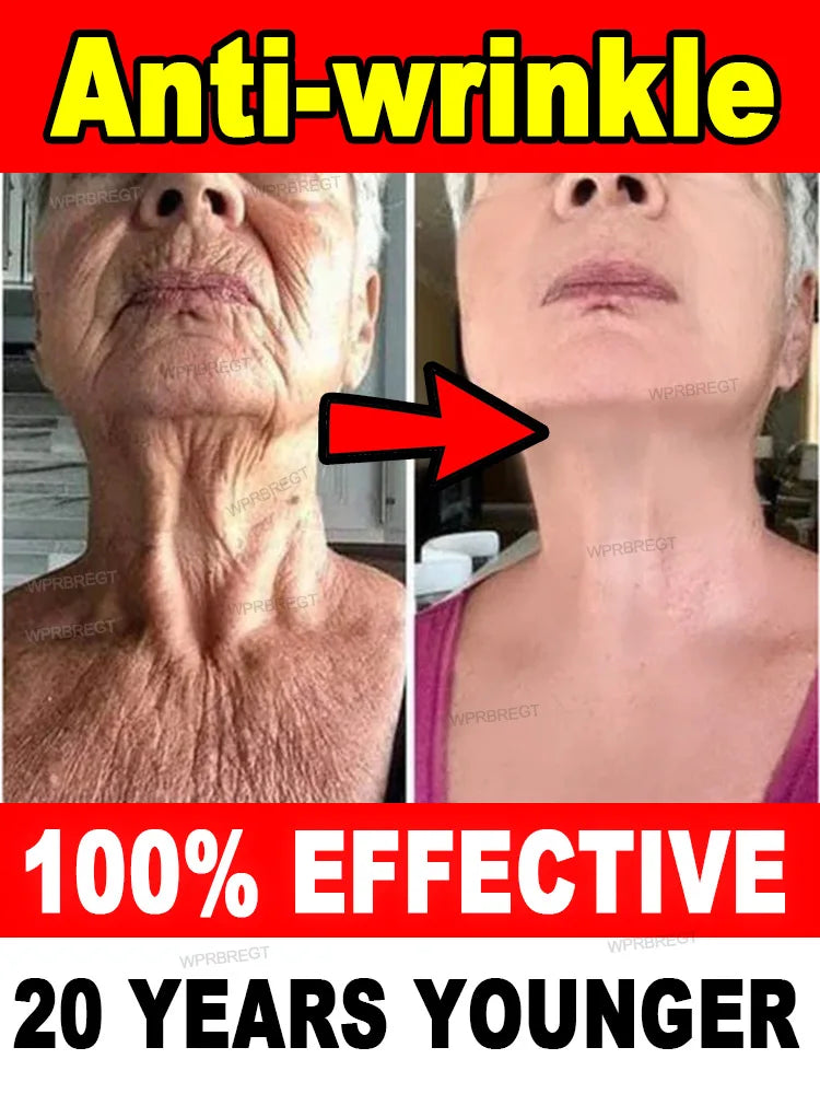 20 years younger, 100% wrinkles disappear